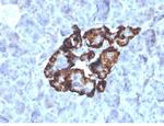 GC Vitamin D Binding Protein Monoclonal Antibody (VDBP/4481)