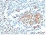 GC Vitamin D Binding Protein Monoclonal Antibody (VDBP/4482)