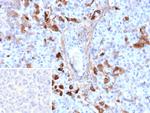 GC Vitamin D Binding Protein Monoclonal Antibody (VDBP/9980)