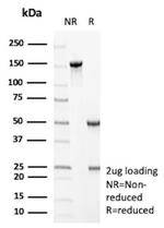 GC Vitamin D Binding Protein Antibody in SDS-PAGE (SDS-PAGE)