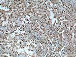 CCDC59 Antibody in Immunohistochemistry (Paraffin) (IHC (P))