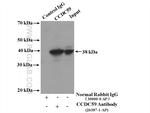 CCDC59 Antibody in Immunoprecipitation (IP)