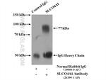 SLCO4A1 Antibody in Immunoprecipitation (IP)