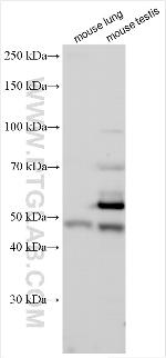 LRRC6 Antibody in Western Blot (WB)
