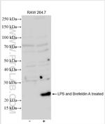 IL-6 Antibody in Western Blot (WB)