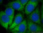 WISP3 Antibody in Immunocytochemistry (ICC/IF)