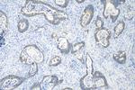 WISP3 Antibody in Immunohistochemistry (Paraffin) (IHC (P))