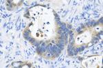 WISP3 Antibody in Immunohistochemistry (Paraffin) (IHC (P))