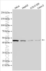 WISP3 Antibody in Western Blot (WB)