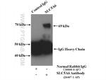 SLC5A6 Antibody in Immunoprecipitation (IP)