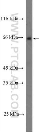 SLC5A6 Antibody in Western Blot (WB)