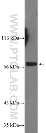 SLC5A6 Antibody in Western Blot (WB)