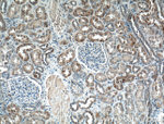 HTR2B Antibody in Immunohistochemistry (Paraffin) (IHC (P))