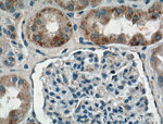HTR2B Polyclonal Antibody