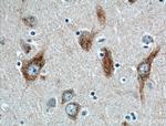 HTR2B Antibody in Immunohistochemistry (Paraffin) (IHC (P))
