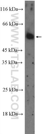 HTR2B Antibody in Western Blot (WB)