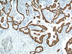 pan-keratin Antibody in Immunohistochemistry (Paraffin) (IHC (P))
