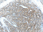 pan-keratin Antibody in Immunohistochemistry (Paraffin) (IHC (P))