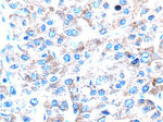 pan-keratin Antibody in Immunohistochemistry (Paraffin) (IHC (P))