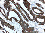 pan-keratin Antibody in Immunohistochemistry (Paraffin) (IHC (P))