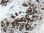 pan-keratin Antibody in Immunohistochemistry (Paraffin) (IHC (P))