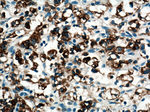 pan-keratin Antibody in Immunohistochemistry (Paraffin) (IHC (P))