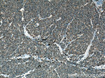 pan-keratin Antibody in Immunohistochemistry (Paraffin) (IHC (P))