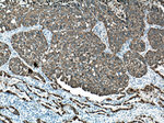 pan-keratin Antibody in Immunohistochemistry (Paraffin) (IHC (P))