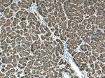 pan-keratin Antibody in Immunohistochemistry (Paraffin) (IHC (P))