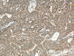VEGF Receptor 2 Antibody in Immunohistochemistry (Paraffin) (IHC (P))