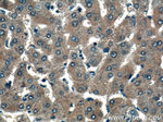 VEGF Receptor 2 Antibody in Immunohistochemistry (Paraffin) (IHC (P))