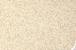 SLC29A4 Antibody in Immunohistochemistry (Paraffin) (IHC (P))