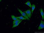 SUNC1 Antibody in Immunocytochemistry (ICC/IF)