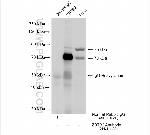 ZBTB2 Antibody in Immunoprecipitation (IP)