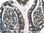 5HT2A Receptor Antibody in Immunohistochemistry (Paraffin) (IHC (P))