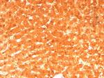 GCHFR Antibody in Immunohistochemistry (Paraffin) (IHC (P))