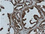SRMS Antibody in Immunohistochemistry (Paraffin) (IHC (P))