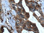 SRMS Antibody in Immunohistochemistry (Paraffin) (IHC (P))