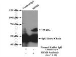 SRMS Antibody in Immunoprecipitation (IP)