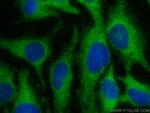 MOS Antibody in Immunocytochemistry (ICC/IF)
