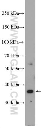 MOS Antibody in Western Blot (WB)