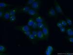 GMAP-210 Antibody in Immunocytochemistry (ICC/IF)
