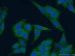 Ch-TOG Antibody in Immunocytochemistry (ICC/IF)