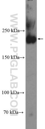 Ch-TOG Antibody in Western Blot (WB)