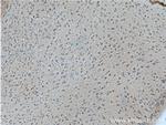 GALR2 Antibody in Immunohistochemistry (Paraffin) (IHC (P))