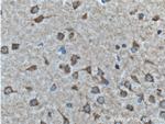 GALR2 Antibody in Immunohistochemistry (Paraffin) (IHC (P))