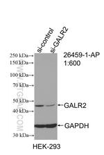 GALR2 Antibody in Western Blot (WB)