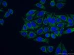 GLE1 Antibody in Immunocytochemistry (ICC/IF)