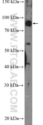 GLE1 Antibody in Western Blot (WB)