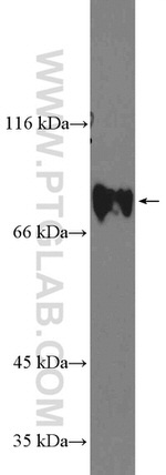 GLE1 Antibody in Western Blot (WB)